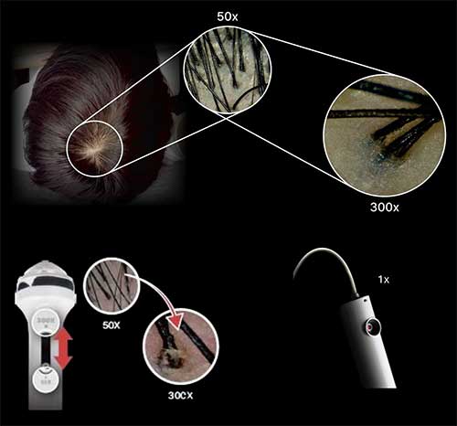 zoom-camera-hsc-pro zoom-camera-hsc-pro
